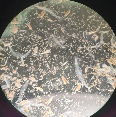 Zooplankton under the microscope